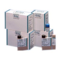 HÓA CHẤT XÉT NGHIỆM SINH HÓA ERBA LACHEMA S.R.O